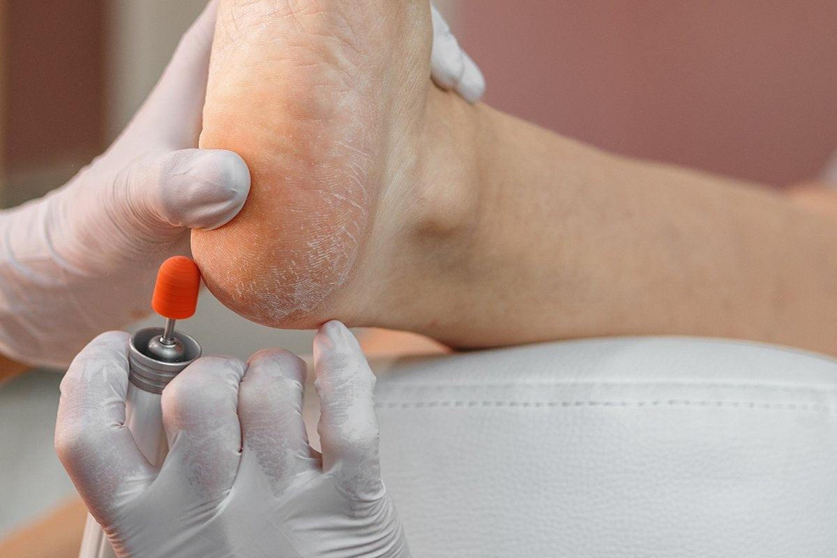 ¿Qué recomiendan los podólogos para los pies secos y agrietados?